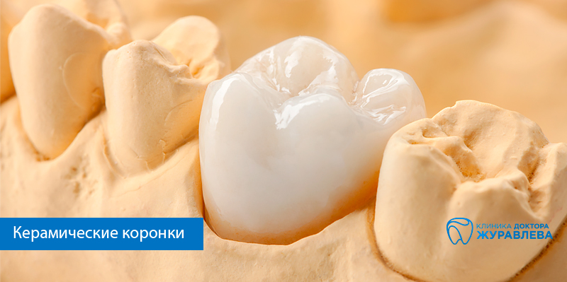 керамическая коронка на зубе