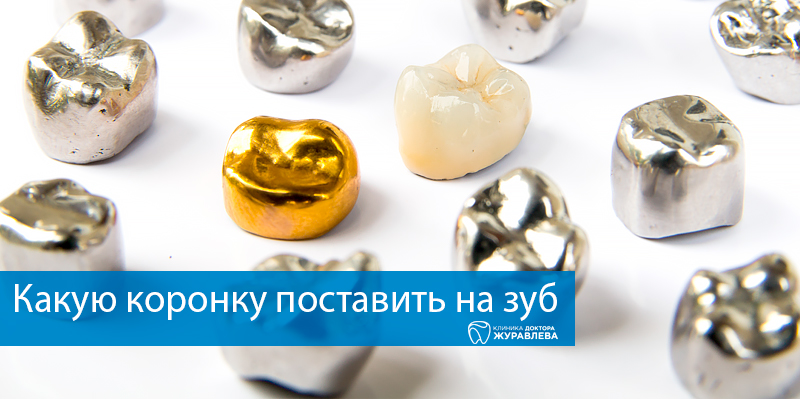 Коронка на зуб - установка и стоимость