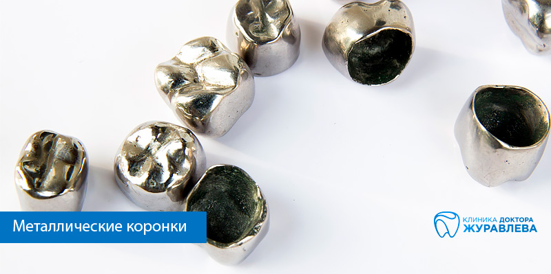 металлическая коронка на зуб